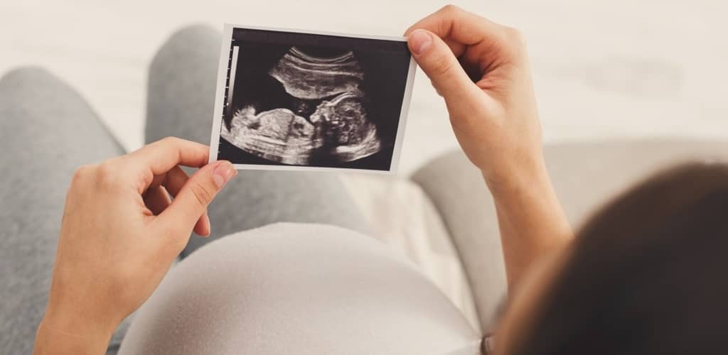 Birth Injury in Los Angeles